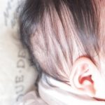 赤ちゃんの頭皮の皮むける原因 カサカサケア方法は?皮膚科に行くべき?