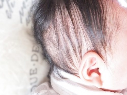 赤ちゃんの頭皮の皮むける原因 カサカサケア方法は 皮膚科に行くべき ｈａｎａの知恵袋